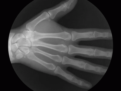 Chapas de raio-x animadas mostram como funcionam as articulações do corpo